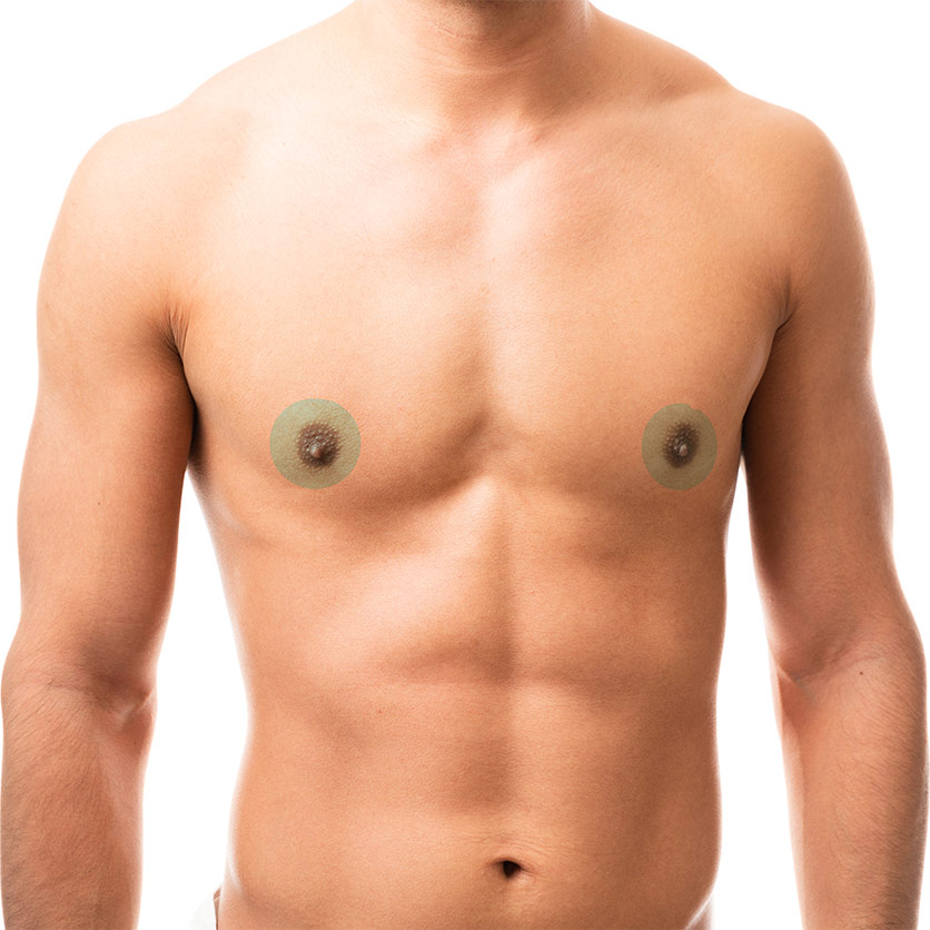 Areolas treatment area for men